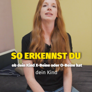 So erkennst du, ob dein Kind X oder O Beine entwickelt.