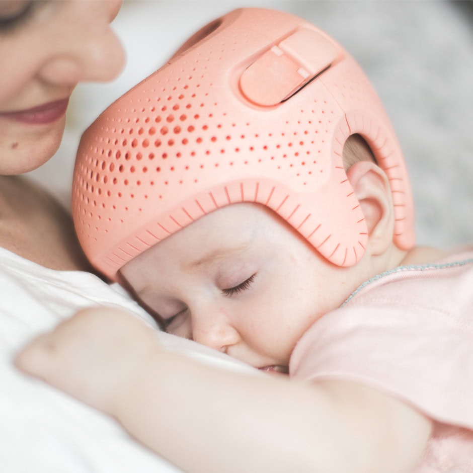 Helmtherapie-Baby-Kopfverformung_2_quadrat Korrekturhelm bei lagerungsbedingter Kopfdeformität